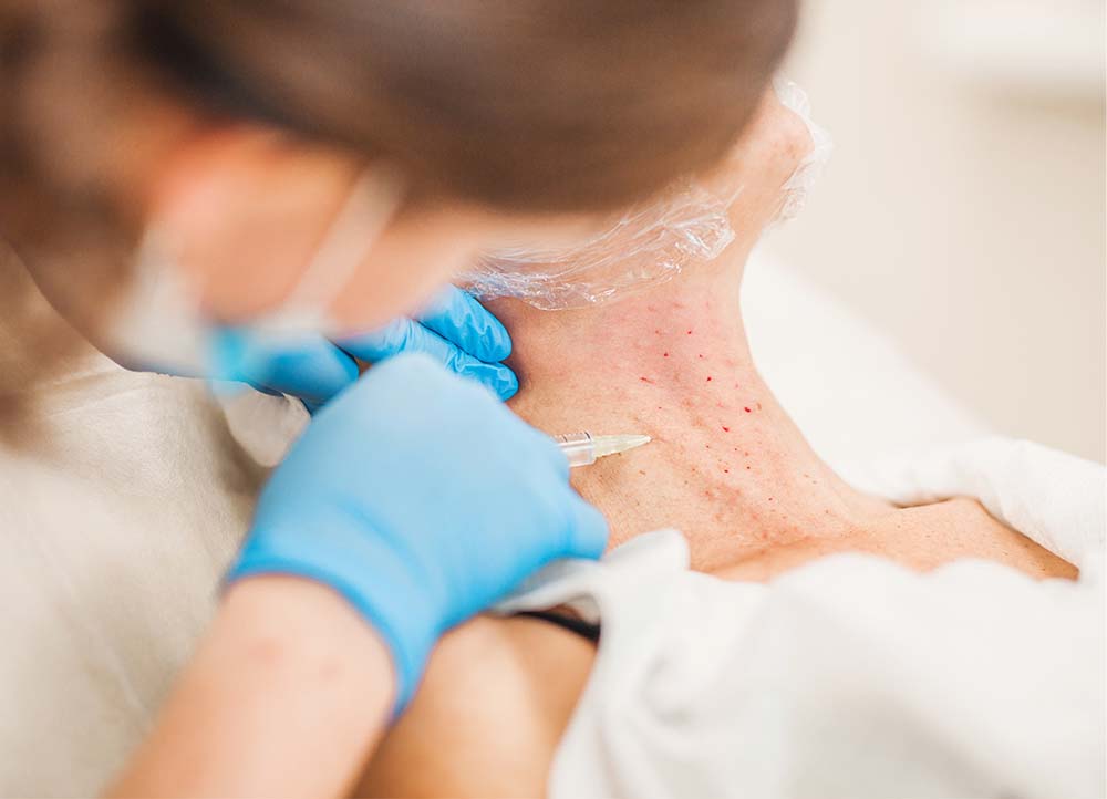 Clinician administering a trigger point injection in the neck